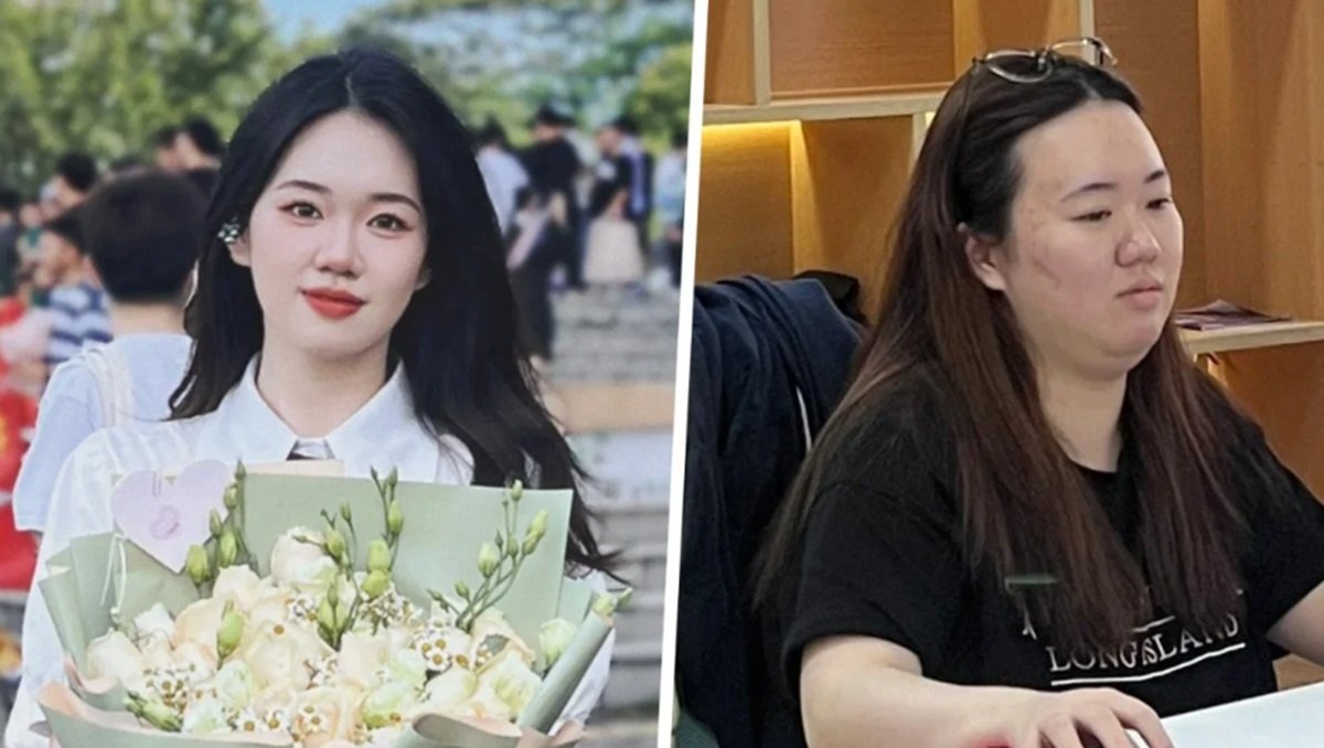 Viral Gadis Cantik China Obesitas, Begini Penampakannya