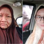 Viral, Muka Berubah Seperti Nenek-Nenek Saat Hamil