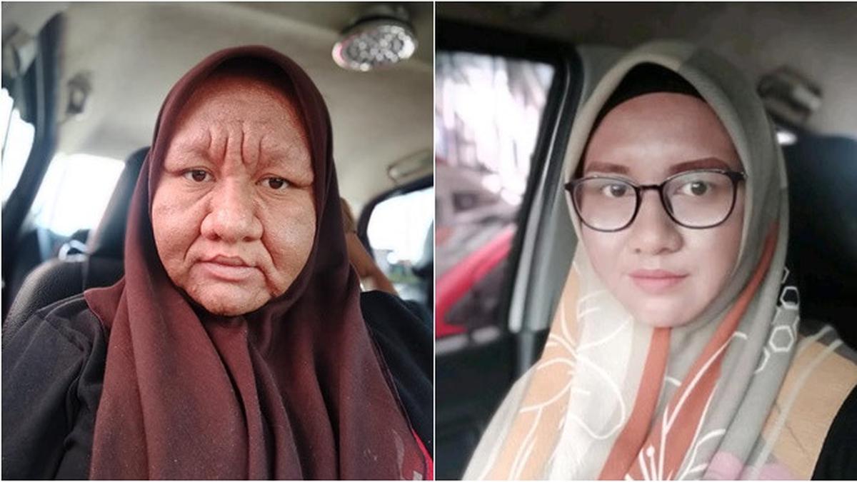 Viral, Muka Berubah Seperti Nenek-Nenek Saat Hamil